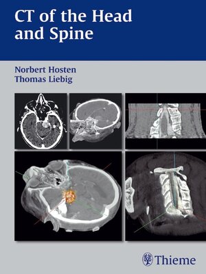 cover image of CT of the Head and Spine